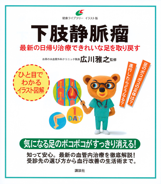 下肢静脈瘤