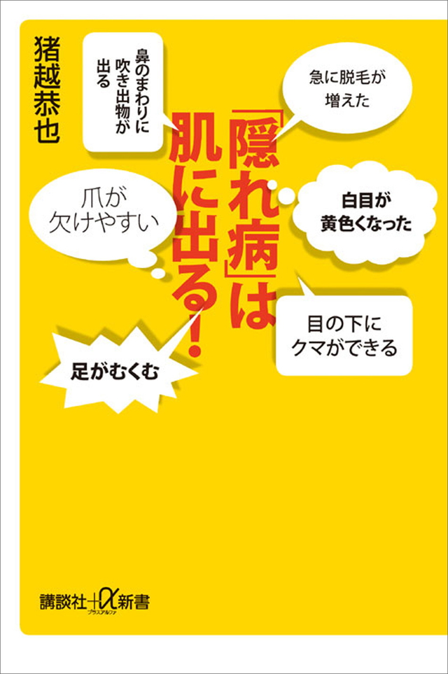 「隠れ病」は肌に出る!